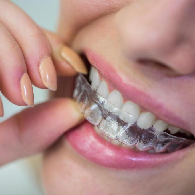 Figsdental Singapore