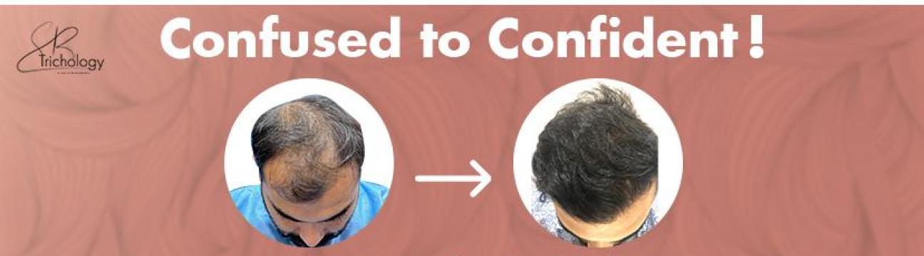 SBTrichology Clinic